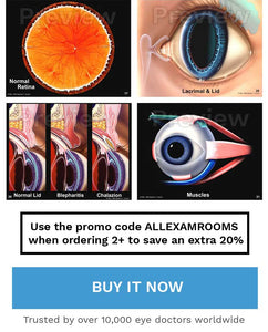 Eye Flip Chart